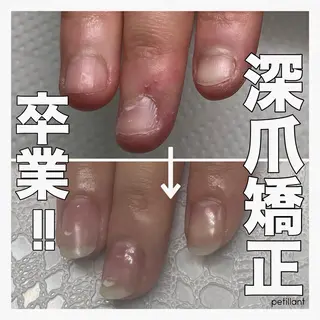 ネイル nail salon petillantのネイルデザイン