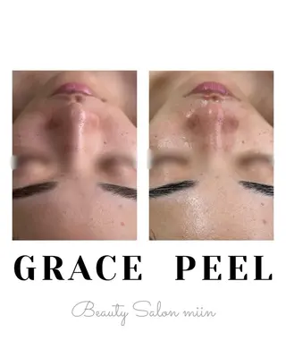 韓国肌管理 白玉肌管理®︎のエステ・リラクイメージ