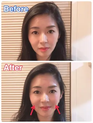 鍼灸 Refineのその他イメージ