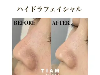 美肌サロンTIAM by tetoteのエステ・リラクイメージ