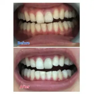 Ｍ渋谷 ホワイトニングのエステ・リラクイメージ