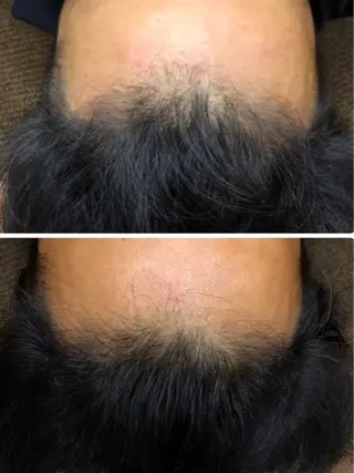 かすがい鍼灸院 Re.heartのエステ・リラクイメージ