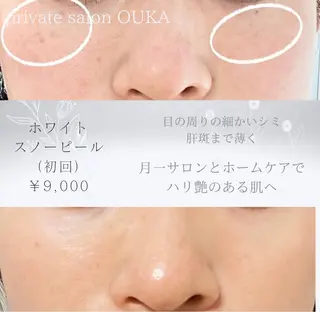 OUKA脱毛 毛穴ケアフェイシャルのエステ・リラクイメージ