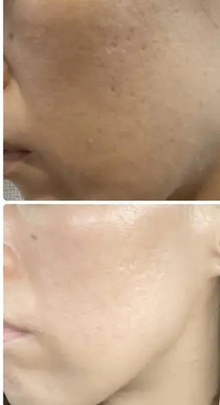 EYE LASH LAPISのエステ・リラクイメージ