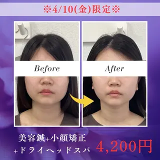 メディカルサロンドオフ所属・ハリサロンドオフ 美容鍼灸×小顔整体のエステ・リラクイメージ