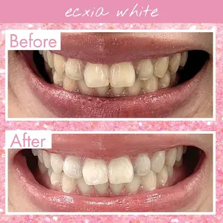 セルフホワイトニングエクシアホワイト草加店所属・セルフホワイトニング エクシア草加店のその他イメージ