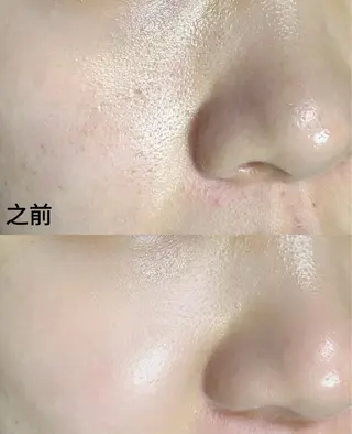 ショート aliaハーブ水光店 エステティシャン募集のエステ・リラクイメージ