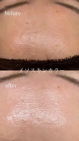 肌質改善サロン réposのその他イメージ