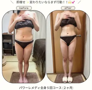 《本気痩せ×疲労改善 》  BILOOPのエステ・リラクイメージ