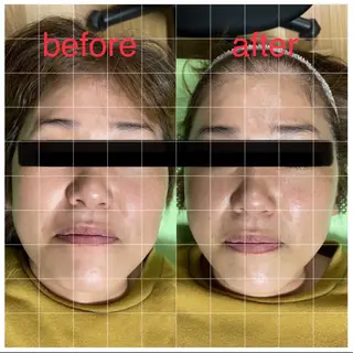 蓮花鍼灸整骨院所属・蓮花鍼灸 整骨院のエステ・リラクイメージ