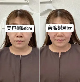 美容鍼灸×小顔整体♡ ハリサロンドオフ堺東のその他イメージ