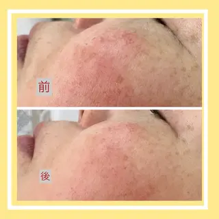 たるみ改善小顔エステ 堀葉月のその他イメージ