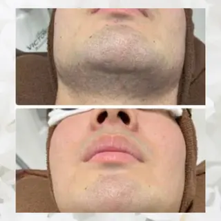 メンズ Laviere nail&脱毛サロンのエステ・リラクイメージ