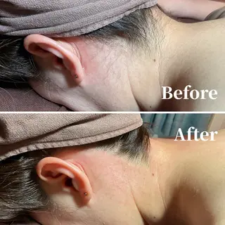 エピナス町田店 ブラジリアンワックスのエステ・リラクイメージ