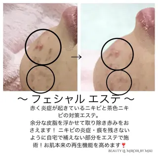 ビューティー ミロワールのエステ・リラクイメージ