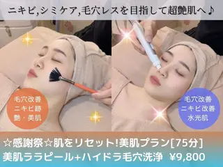 美容鍼灸/小顔鍼灸 肌質改善エステのエステ・リラクイメージ