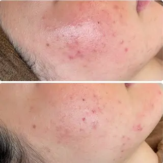 esthesalon O'-en-のエステ・リラクイメージ