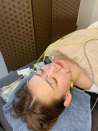 特別クーポン配布中 美容鍼・整体お得に！のその他イメージ