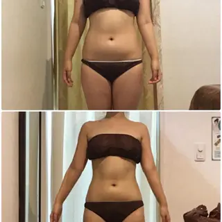 脱毛・ハイフ ・フェアリーのエステ・リラクイメージ