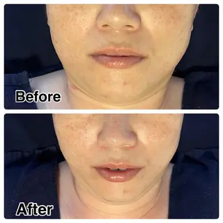 🌴Beauty Salon LANAのエステ・リラクイメージ