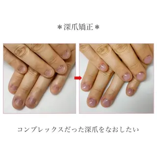 ネイル ネイルサロン アリュームのネイルデザイン