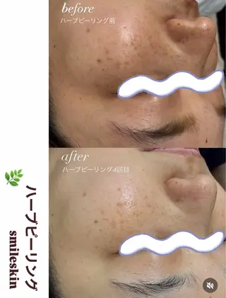 smile nail スマイルネイルのその他イメージ