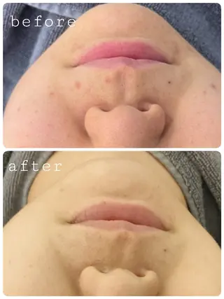 キダ ノリコのエステ・リラクイメージ