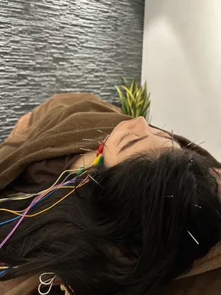 小顔矯/美容鍼/鍼灸 BeauJuのその他イメージ