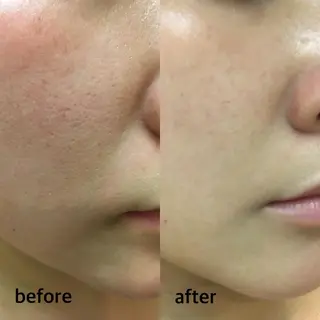 美楽鍼 びらくしんのその他イメージ