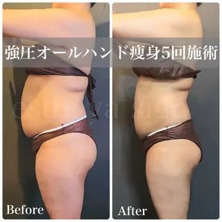 深層筋×筋膜リリース 首肩こり/むくみのエステ・リラクイメージ