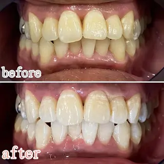 ホワイトニングサロン CREWのその他イメージ