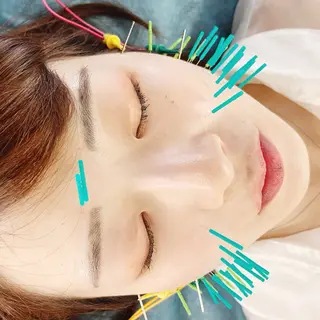 渋谷 小顔美容鍼 専門サロン YZのエステ・リラクイメージ