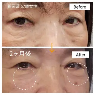 天使のしずく 神戸店所属・幹細胞エクソソーム 専門店 天使のしずくのその他イメージ