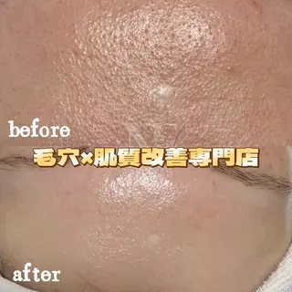 Nature Souce毛穴専門店のその他イメージ