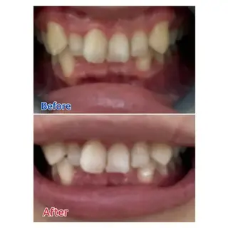 M渋谷 ホワイトニングのエステ・リラクイメージ