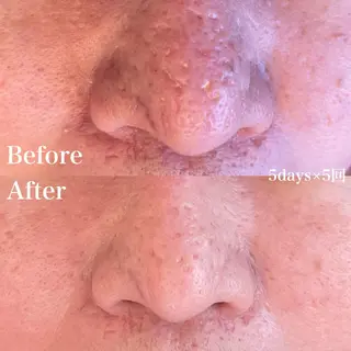 グリーンピール専門店 サロンY【大阪】のエステ・リラクイメージ