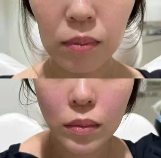 マツエク・マツパ aliaハイフ&水光ジェットサロン所属・aliaハーブ水光店 エステティシャン募集のエステ・リラクイメージ