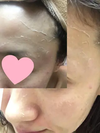 Momo Eggsのエステ・リラクイメージ