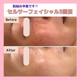 三沢市エステサロン Sブランペタルのエステ・リラクイメージ