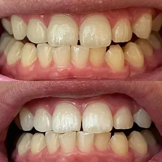 MEE ｜MIHOのその他イメージ