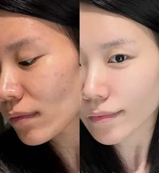 マツエク・マツパ aliaハーブ水光店 エステティシャン募集のエステ・リラクイメージ