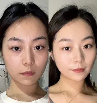 ネイル aliaハイフ&水光ジェットサロン所属・aliaハーブ水光店 エステティシャン募集のエステ・リラクイメージ