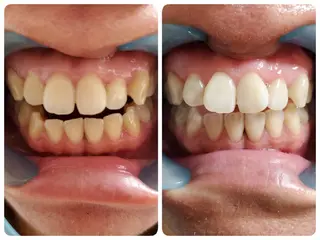 mindplus(マインドプラス)所属・mind plus 【小顔　痩身　脱毛】のエステ・リラクイメージ