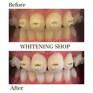 ホワイトニングショップ津店所属・ホワイトニング ショップ津店のその他イメージ