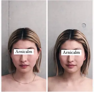 ハーブピーリング 肌再生ピーリング/のエステ・リラクイメージ