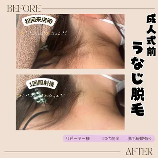 lieupré 脱毛 oshima‎⌣̈のエステ・リラクイメージ