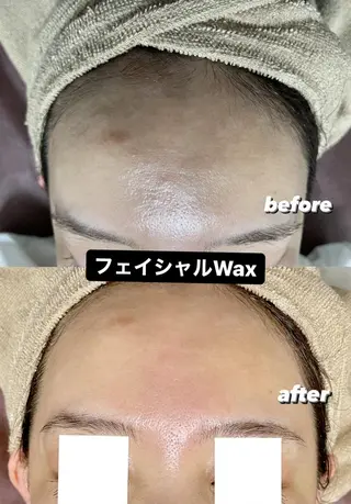 セミロング パーマ メンズ ヘアアレンジ ネイル マツエク・マツパ Epina 千葉店 【エピナ】のエステ・リラクイメージ