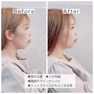 maal mikiのヘアスタイル