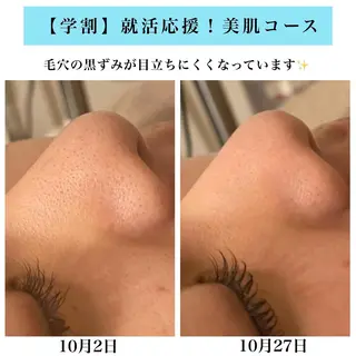 Bellesthe (ベルエステ)のエステ・リラクイメージ