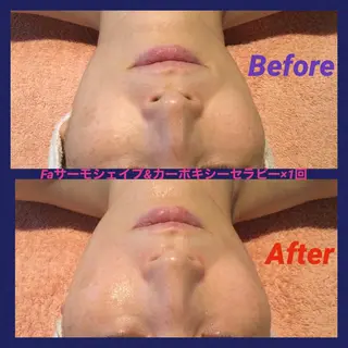 UnCouture 〜アンクチュール〜のエステ・リラクイメージ